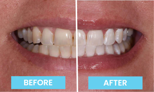 EMILY’S EXPERIENCE